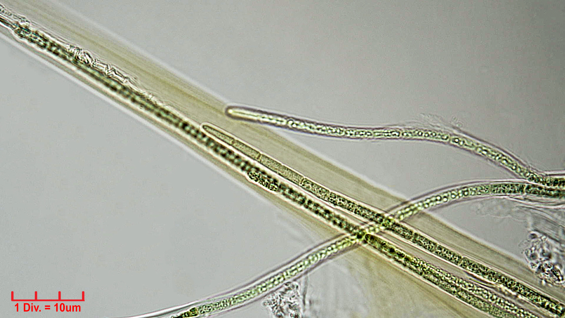 ./././Cyanobacteria/Synechococcales/Schizotrichaceae/Dasygloea/lamyi/Dasyglo2.jpg