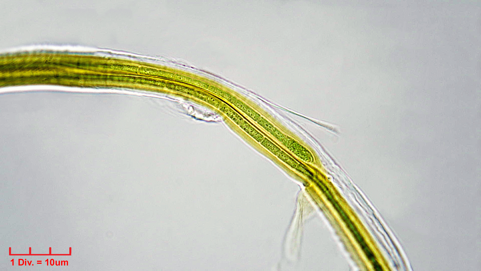 Cyanobacteria/Synechococcales/Schizotrichaceae/Dasygloea/lamyi/Dasyglo3.jpg