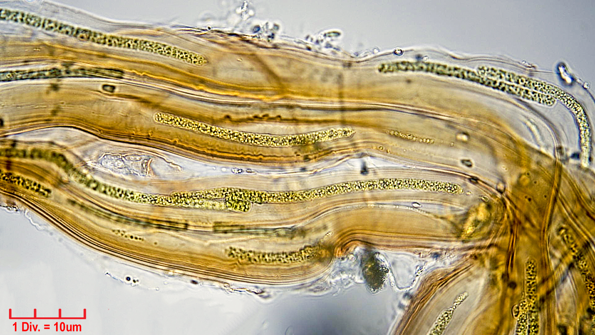 Cyanobacteria/Synechococcales/Schizotrichaceae/Dasygloea/lamyi/Dasyglo5.jpg