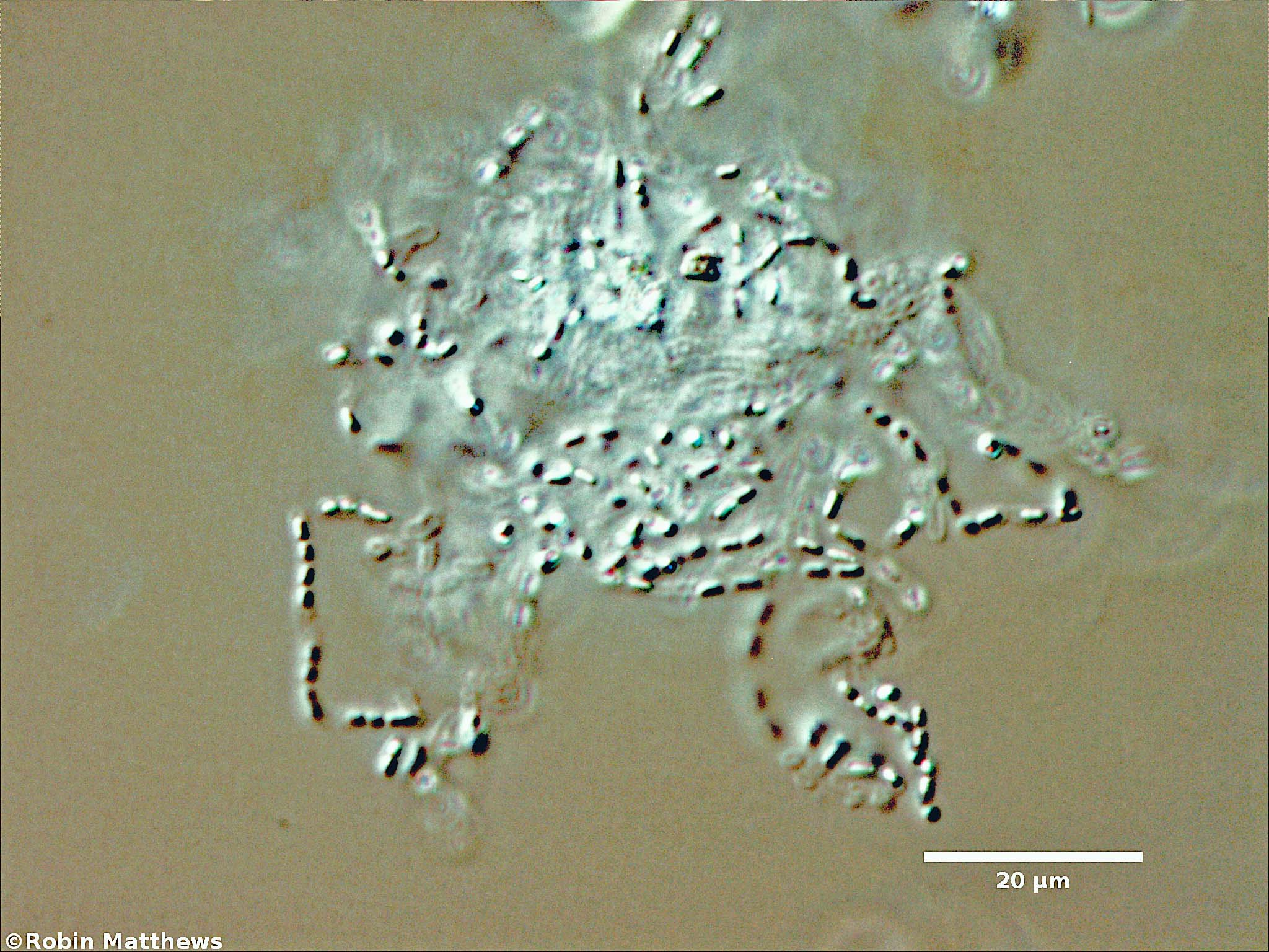 Cyanobacteria/Synechococcales/Synechococcaceae/Cyanodictyon/sp/75.jpg