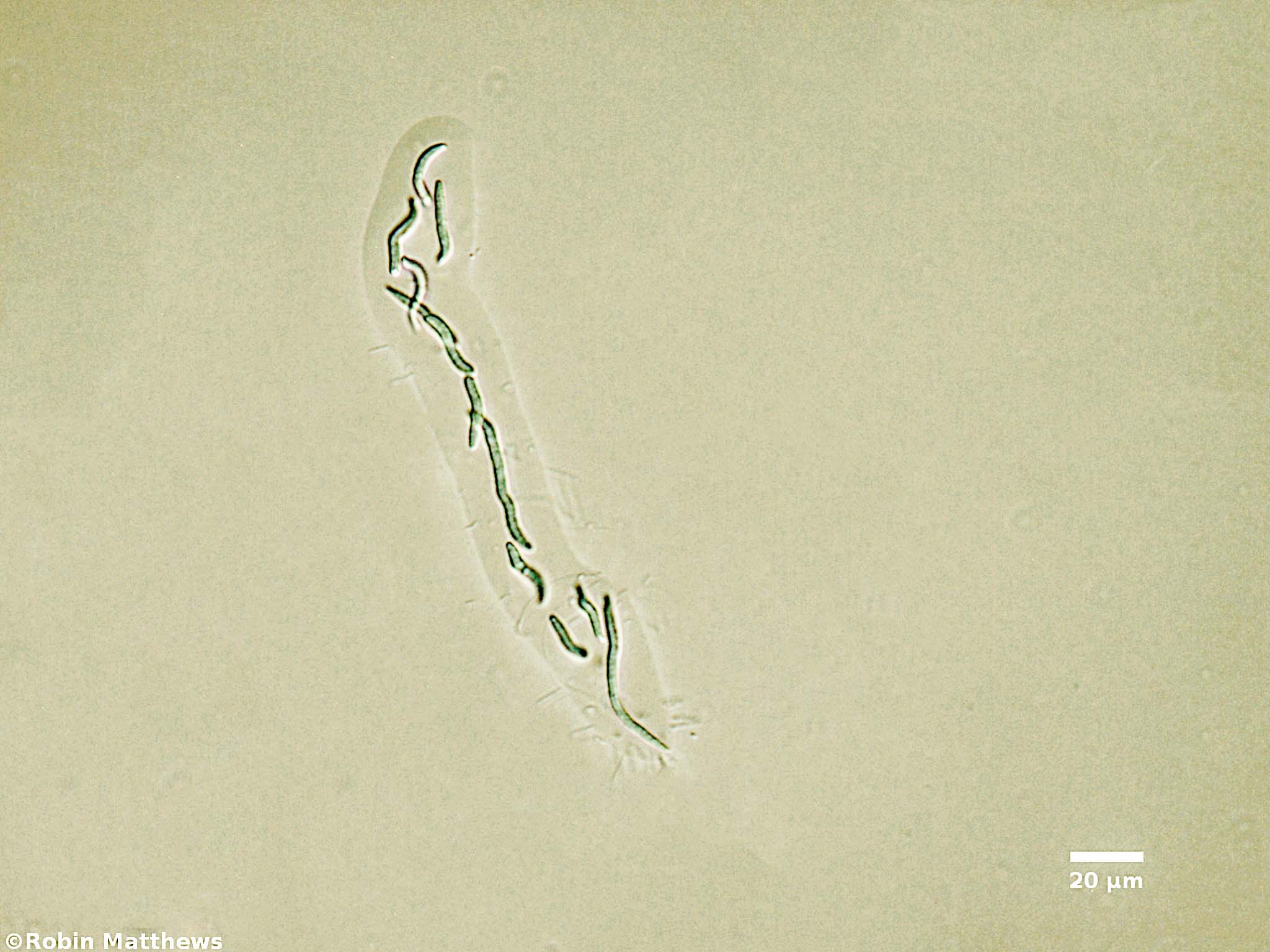 ./././Cyanobacteria/Synechococcales/Synechococcaceae/Rhabdoderma/lineare/69.jpg
