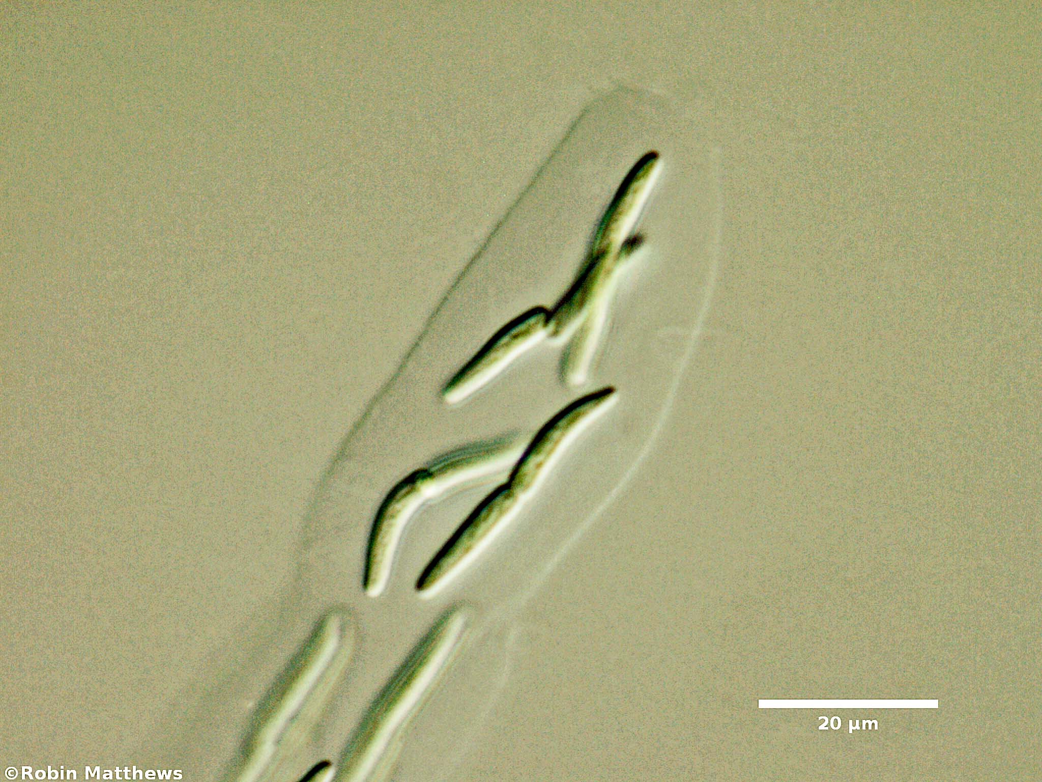 Cyanobacteria/Synechococcales/Synechococcaceae/Rhabdoderma/lineare/70.jpg