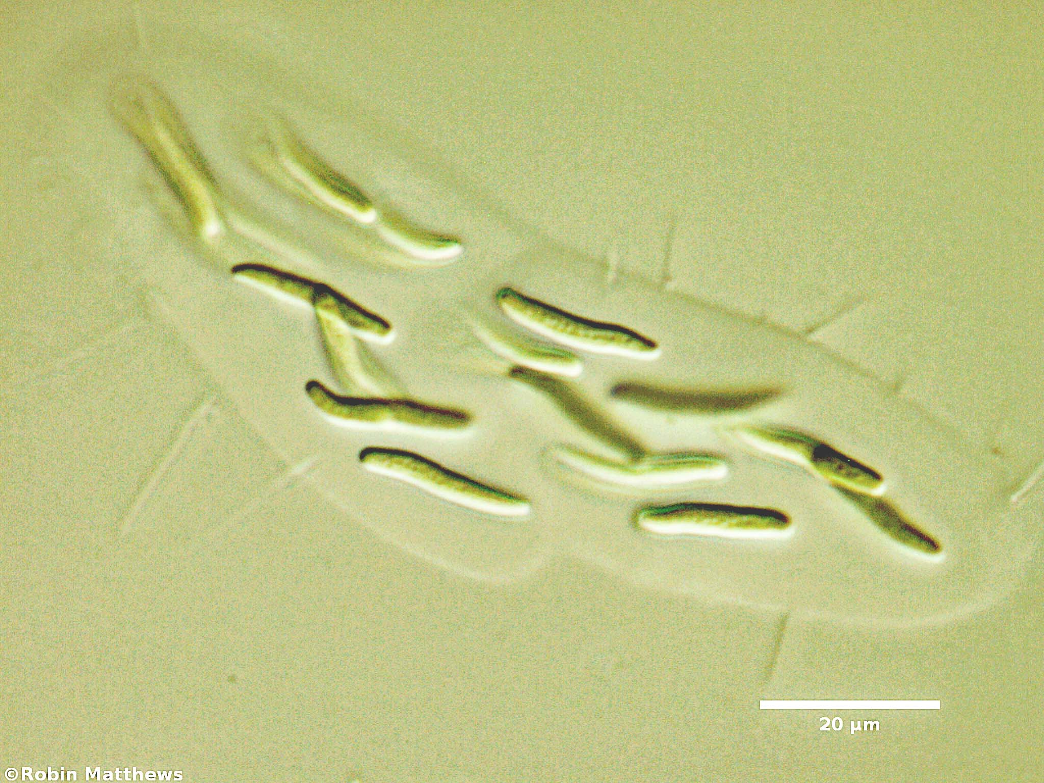 Cyanobacteria/Synechococcales/Synechococcaceae/Rhabdoderma/lineare/71.jpg