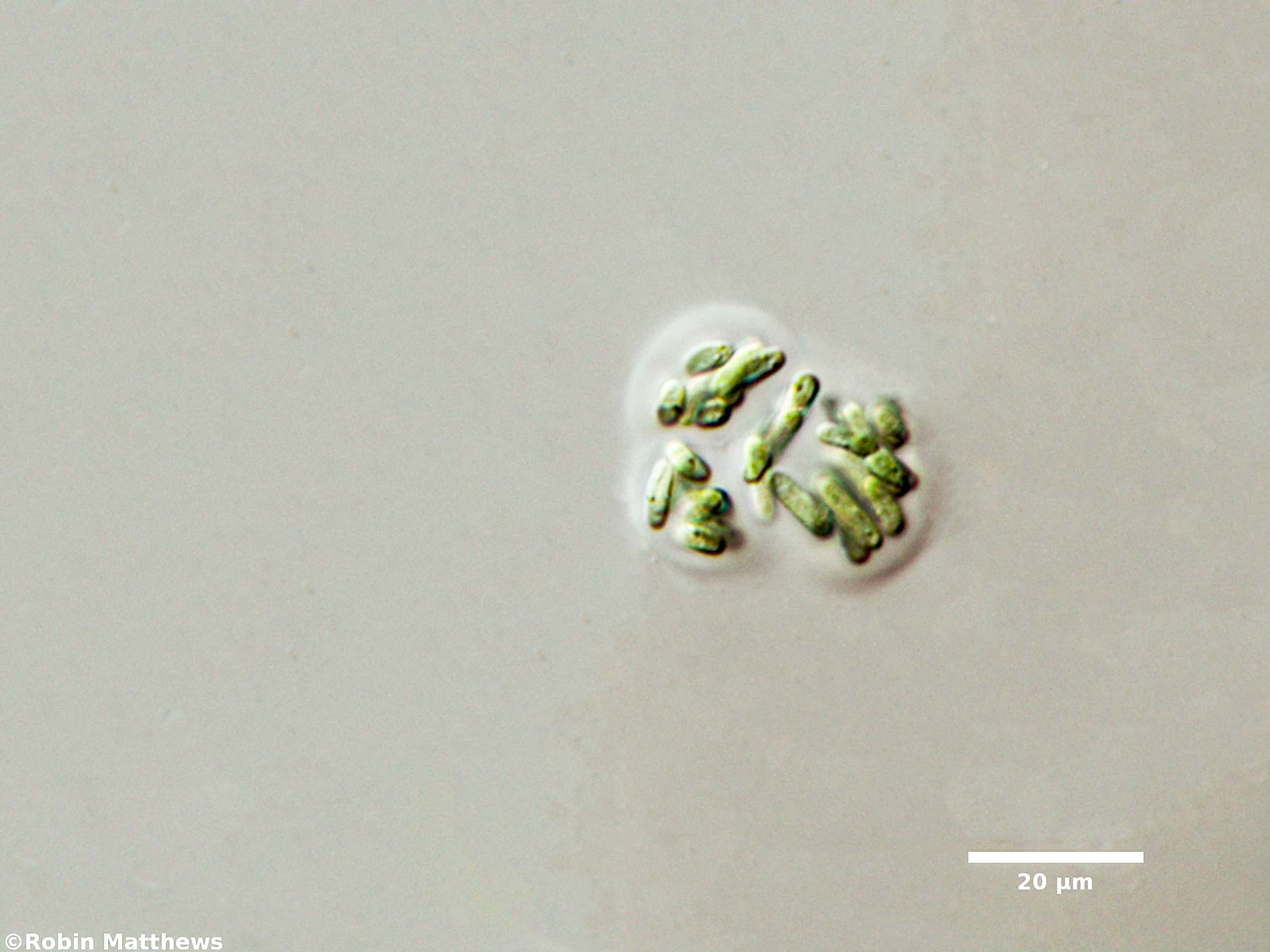 Cyanobacteria/Synechococcales/Synechococcaceae/Rhabdogloea/linearis/73.jpg
